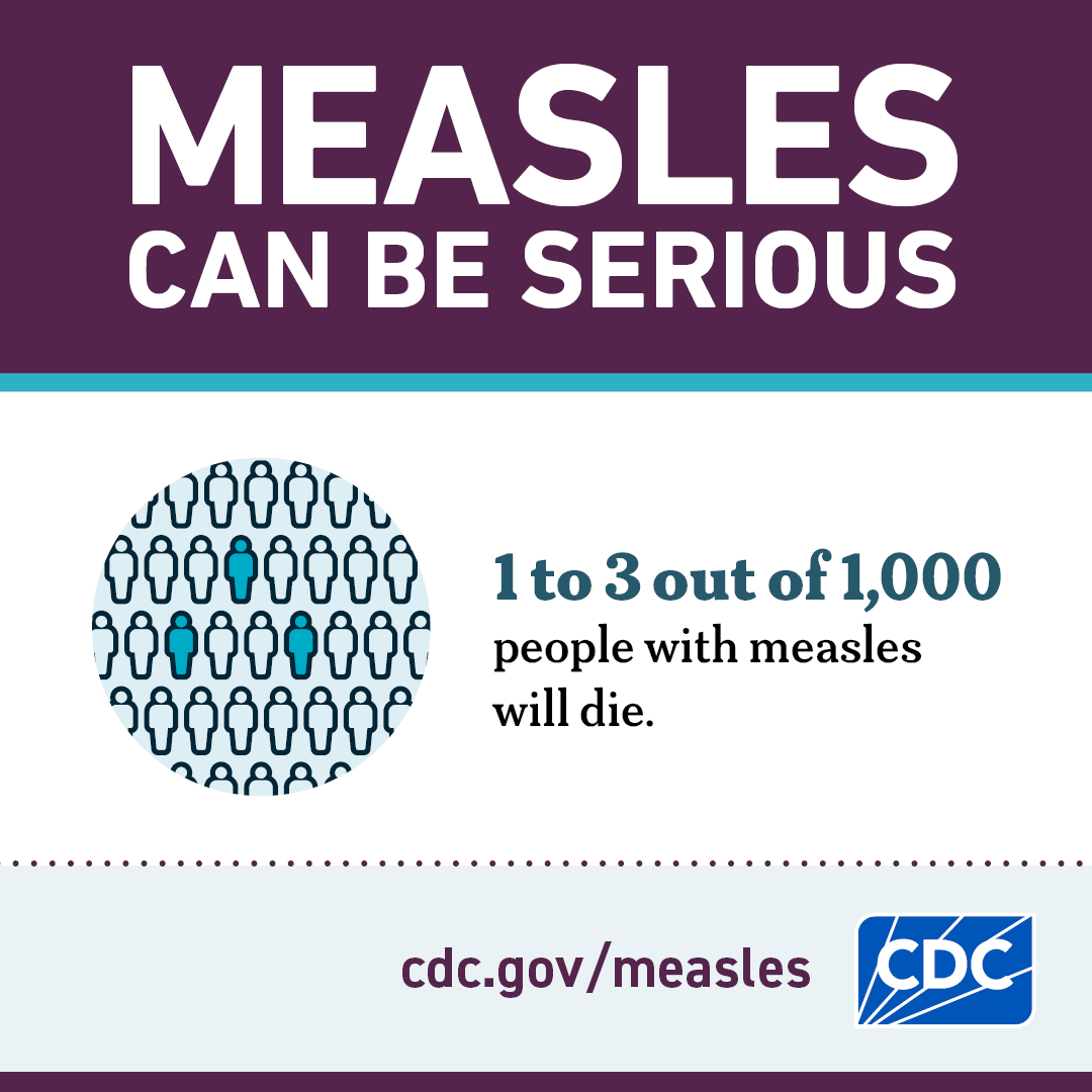 Measles could cause death